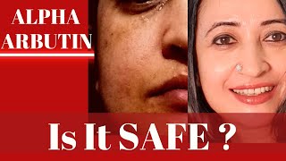 Is Alpha Arbutin Safe in Skin care and Body care Should you stop it After 3 months [upl. by Dibri658]