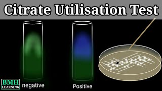 Citrate Utilzation Test  IMViC Test  Simmons Citrate Agar Test  Citrate Test  Simmons Agar [upl. by Quiteri]