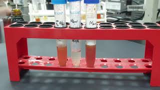 Nitrate reduction test Results [upl. by Balliol]