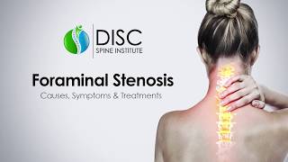 Pinched Nerve in Neck or Back Foraminal Stenosis Causes Symptoms Treatments [upl. by Charo875]