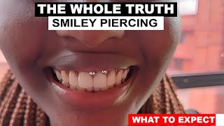 Smiley Piercing  WHAT TO EXPECT  PROCESS [upl. by Hannej465]