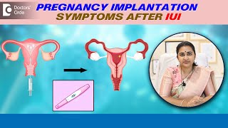 4 Signs of IMPLANTATION after IUI  Pregnancy Implantation Symptoms DrSneha ShettyDoctors Circle [upl. by Eilsel]