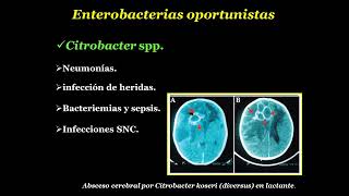 Enterobacterias oportunistas Acinetobacter spp [upl. by Enileda]