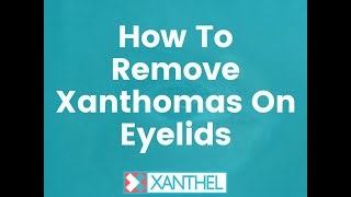 How To Remove Xanthomas On Eyelids  Its easy when you know how   By XANTHEL ® [upl. by Iamhaj872]