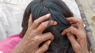 scalp checking ASMR  Heavy lice And nits Removal by hands  Head Checking  Mousaasmr830 [upl. by Nylidam]