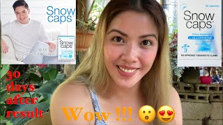 Paano ako Pumuti Part 2 Snowcaps Glutathione Honest Review  30 Days After Result  Regg Villar [upl. by Deming260]