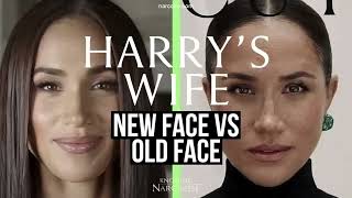 New Face Vs Old Face Meghan Markle [upl. by Astrix945]