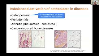 KRWebinar Intravital Imaging for monitoring osteoclast activity within hindlimb long bone [upl. by Tehcac327]