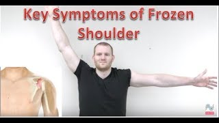 Frozen Shoulder Symptoms  Adhesive Capsulitis Examination [upl. by Druci32]