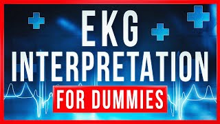 EKG Interpretation for DUMMIES [upl. by Gautea]