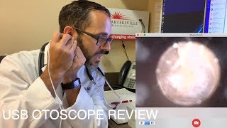 USB OTOSCOPE REVIEW  FOR MEDICAL PROVIDERS [upl. by Yntirb]