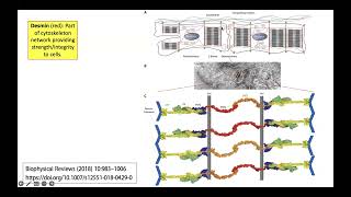 Desminrelated Myopathy [upl. by Larcher]