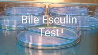 Bile Esculin Test [upl. by Kcired]