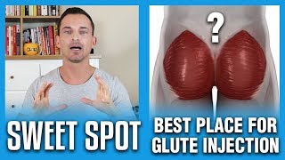 Best Place For Glute Injection  The Sweet Spot [upl. by Hafinah]