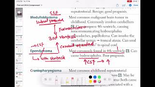 Ependymoma neurology 132  First Aid USMLE Step 1 in UrduHindi [upl. by Beebe]