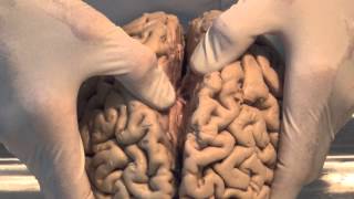 Introduction Neuroanatomy Video Lab  Brain Dissections [upl. by Akehsal]