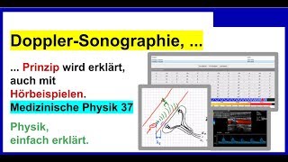 DopplerSonographie Prinzip wird erklärt auch mit Hörbeispiel Für Medizinische Physik 37 [upl. by Laddy]