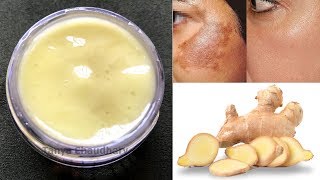 DIY Ginger Cream  Remove Pigmentation Dark Spots amp Acne Scars AntiAging amp Skin Lightening Cream [upl. by Yorgos]