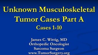 Orthopedic Oncology Course  Unknown Test Cases Part A Cases 110  Lecture 11 [upl. by Fai]