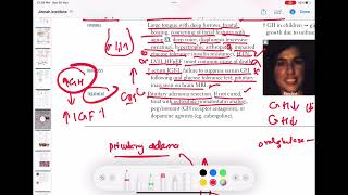 Acromegaly endocrinology 37  First Aid USMLE Step 1 in UrduHindi [upl. by Aicsila116]