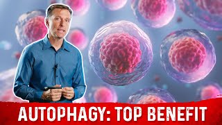 The Most Important Benefit of Autophagy Will Surprise You [upl. by Smitt]