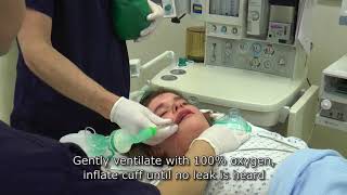 Paediatric Anaesthetics Chapter 3  Intubation rsi child [upl. by Anelec629]