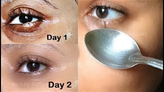 How to Remove Under Eye WRINKLES Under Eye Bags Puffy eyes amp Dark Circles in 1 Day with ice cubes [upl. by Karalynn]