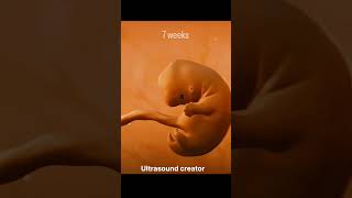 7 Weeks Babybaby doctor pregnant cutebaby health doctors pregnancy ultrasound hospital [upl. by Ananna986]