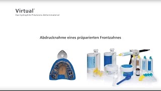 Virtual  Abformung eines präparierten Frontzahnes [upl. by Orecul]