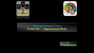 Radiological Anatomy Course Lecture 04 Brain Supratentorial Part1 [upl. by Prudi]