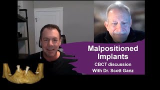 Malpositioned Implants  Dr Scott Ganz [upl. by Pieter]