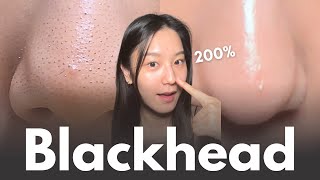 How to really remove blackheads at home in 7 days No matter your skin type [upl. by Noiz968]