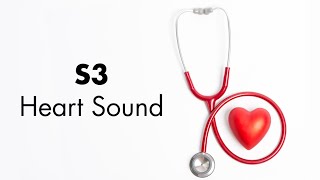 S3 Heart Sound  MEDZCOOL [upl. by Amann656]