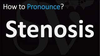 How to Pronounce Stenosis CORRECTLY [upl. by Purdy]