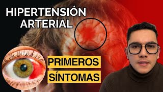 Primeros síntomas de hipertensión arterial  Dr William Guerrero [upl. by Ajiak]