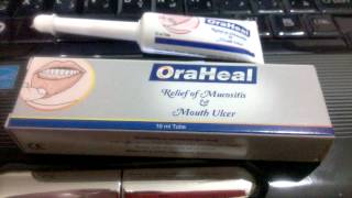 OraHeal Product Review  Canker Sore treatment [upl. by Atileda]