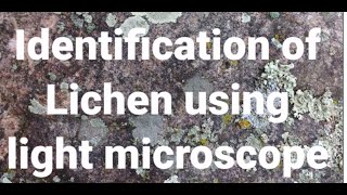 Identification of Lichen using Light microscope [upl. by Ynatterb286]