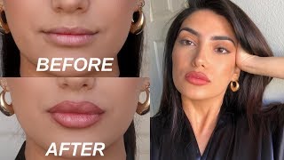 HOW TO FAKE BIG LIPS IN 3 EASY STEPS OMG [upl. by Fugate609]