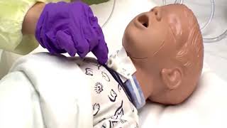 Tracheostomy Suctioning [upl. by Hazel736]