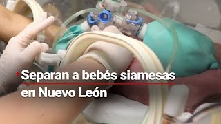 ¡UN ROTUNDO ÉXITO Separan a bebés siamesas que nacieron unidas por el abdomen en Nuevo León [upl. by Anirahtak349]