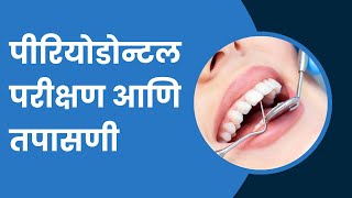 पीरियोडोन्टल परीक्षण आणि तपासणी  Periodontal Examination and Probing in Marathi [upl. by Seebeck892]