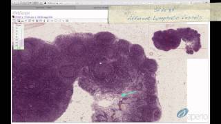 Histology Helper  Lymphoid Tissue Histology [upl. by Ahcsim]