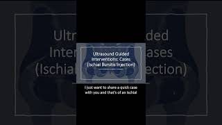 Ultrasound Guided Interventions Cases Ischial Bursitis Injection [upl. by Ranique]