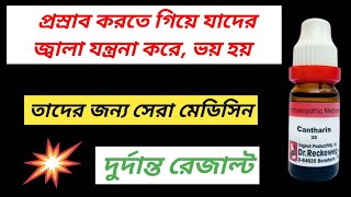 Cantharis Homeo Medicine । প্রসাবের রাস্তায় ব্যথা । [upl. by Alberto]