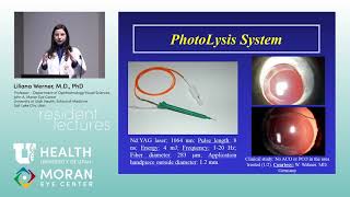 Ocular Pathology IOLs and Capsular Bag Opacification [upl. by Lewendal]