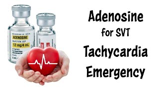 Treating Supraventricular Tachycardia SVT with Adenosine [upl. by Pickar]