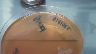 Serratia mercescens growth on broth  Bactec vial and MacConkey agar  Neonatal sepsis [upl. by Imoian]