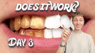 Testing the ‘viral’ TEETH WHITENING STRIPS Day3 [upl. by Oigolue]