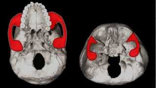 Starchild Skull For Dummies [upl. by Grote]