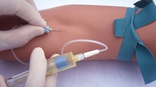 Performing a venipuncture using a butterfly needle [upl. by Enirahtac]